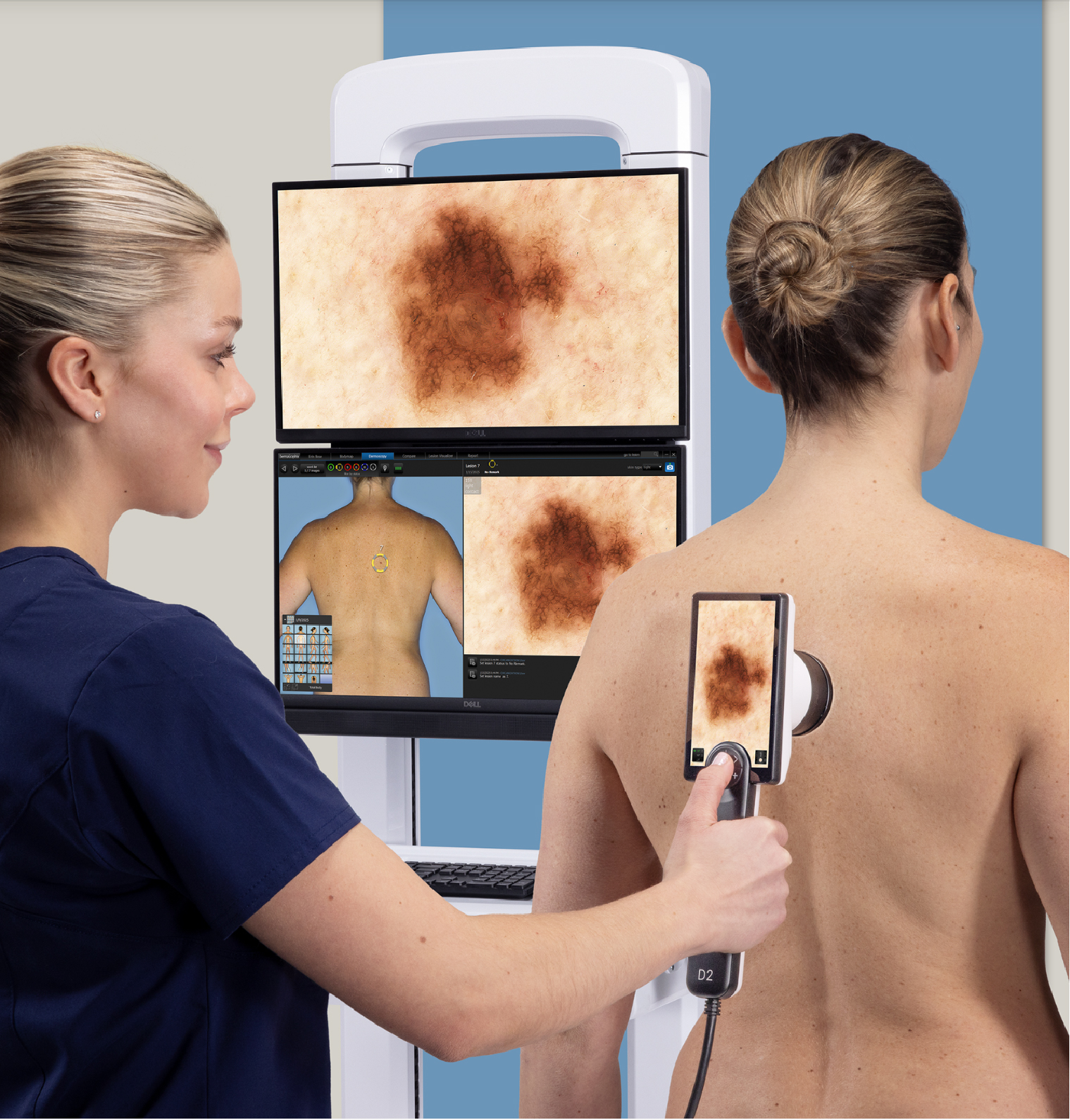 Mole mapping in Edmonton